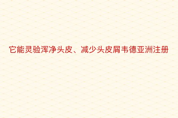 它能灵验浑净头皮、减少头皮屑韦德亚洲注册